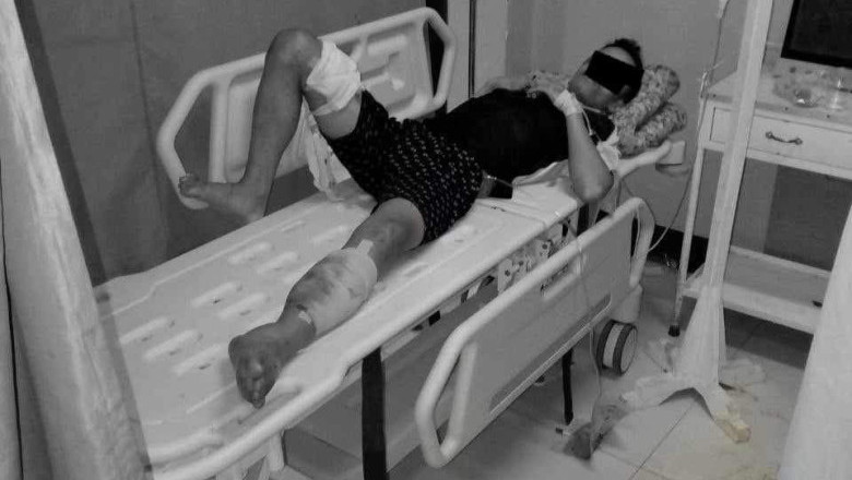 Soldiers rescue injured, abandoned NPA member after Bukidnon clash